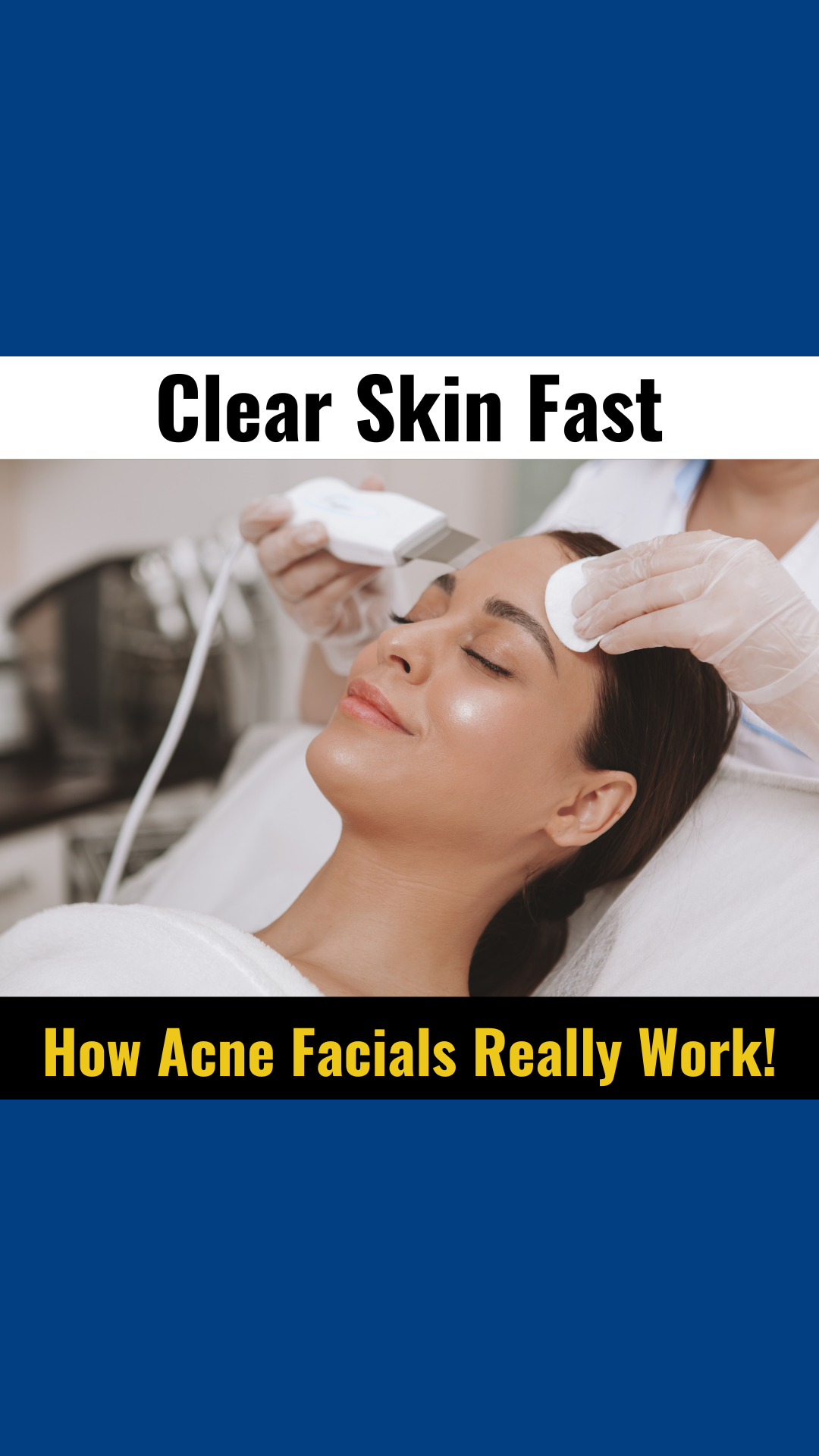 Videographer 32 Clear Skin Fast How Acne Facials Really Work!