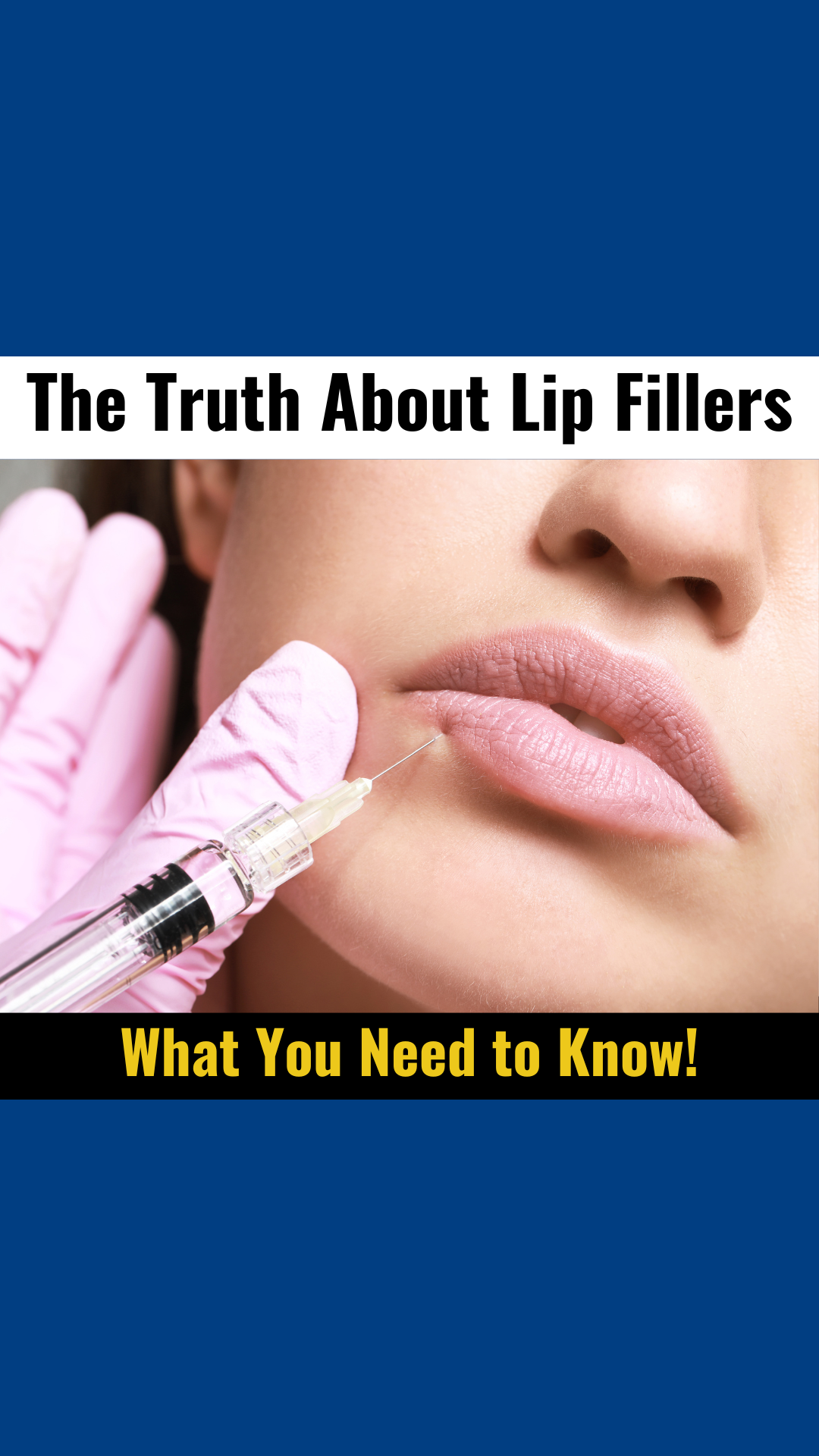 Videographer 35 The Truth About Lip Fillers What You Need to Know!